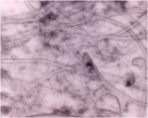 Цианобактерии, фото микроскопа