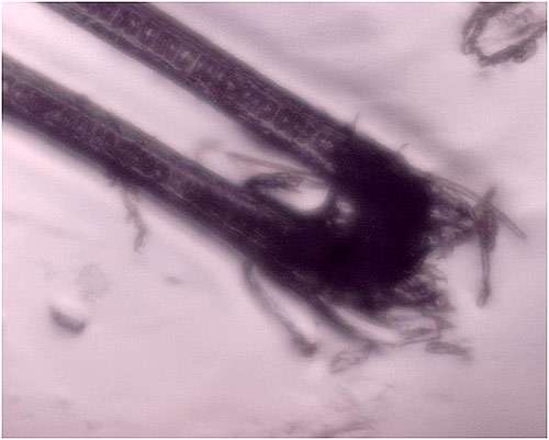 Цианобактерии, свернувшиеся в жгуты, фото изображение