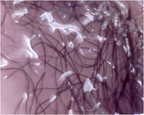 Волокна цианобактерий в коже, фото фотография