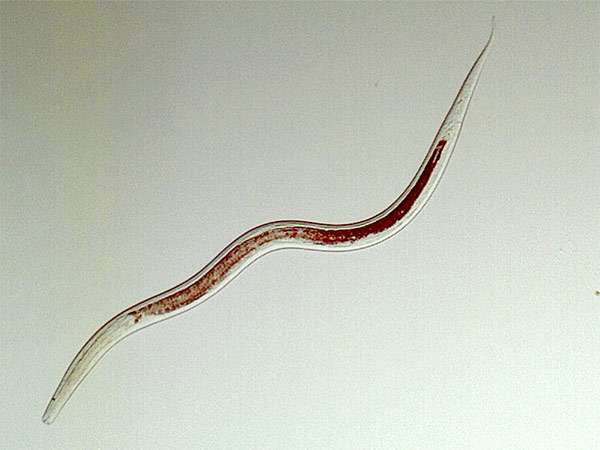 Нематода, или глист (Monhystera stagnalis), фото круглые черви фотография
