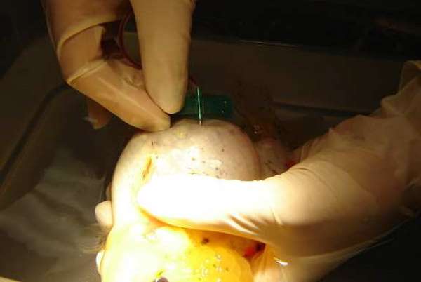 Операция по выдавливанию содержимого кисты, фото фотография болезни аквариумных рыб