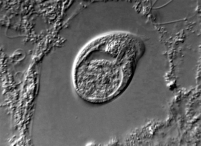Ресничная инфузория Chilodonella cyprini, фото фотография под микроскопом