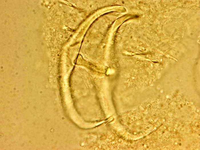 Сосальщик дактилогирус (Dactylogyrus), фото фотография болезни рыб