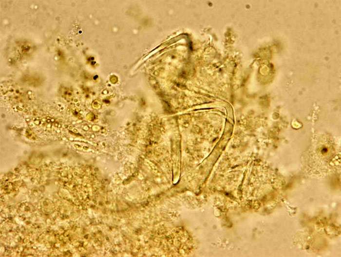 Сосальщик дактилогирус (Dactylogyrus inexpectatus), фото фотография болезни рыб