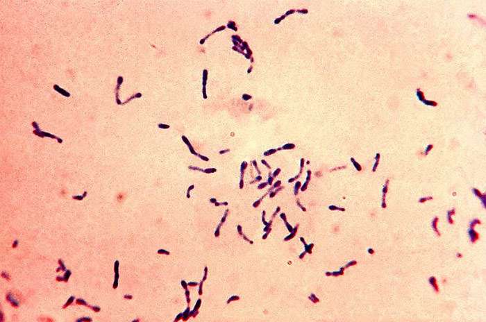 Corynebacterium diphtheriae, фото фотография бактерии