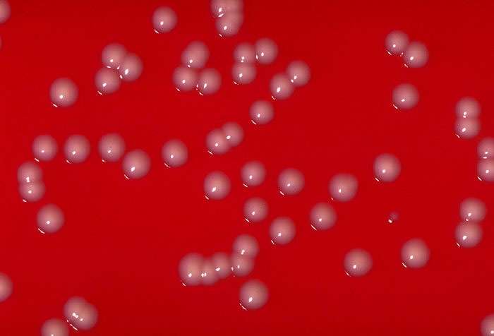 Corynebacterium ulcerans, фото фотография бактерии