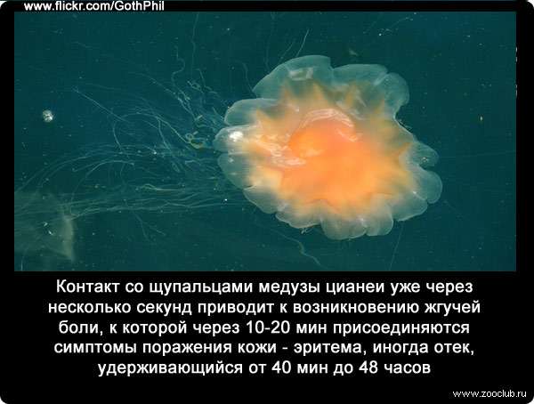 Контакт со щупальцами медузы цианеи (Cyanea capillata) уже через несколько секунд приводит к возникновению жгучей боли, к которой через 10-20 мин присоединяются симптомы поражения кожи - эритема, иногда отек, удерживающийся от 40 мин до 48 часов. 