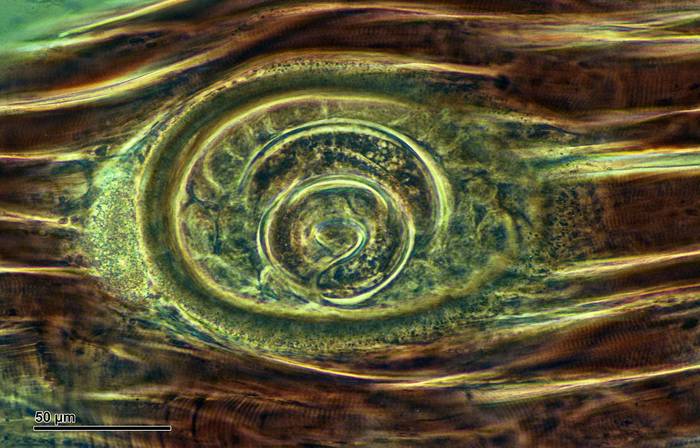 Трихинелла Trichinella spiralis, фото фотография черви