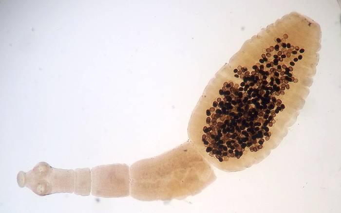 Эхинококк (Echinococcus granulosus), фото фотография беспозвоночные