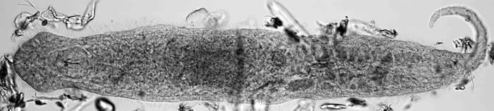Гнатостомулида Gnathostomula paradoxa, фото фотография беспозвоночные