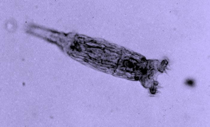 Пиявковидная коловратка (Bdelloidea), фото фотография беспозвоночные