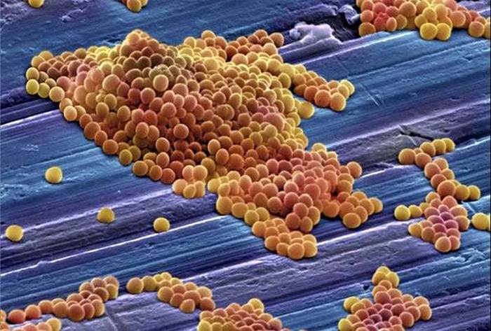 Золотистый стафилококк (Staphylococcus aureus), фото фотография