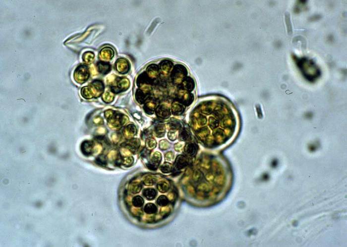 Coelastrum microporum, фото фотография водоросли